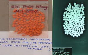 Nhiều trẻ ngộ độc chì từ thuốc cam rởm